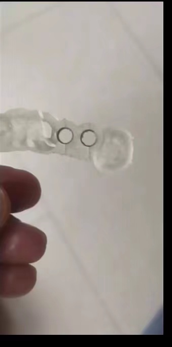 Resin Dental 3D Printer Planti - Dental 3D Printer Resin recension och pris