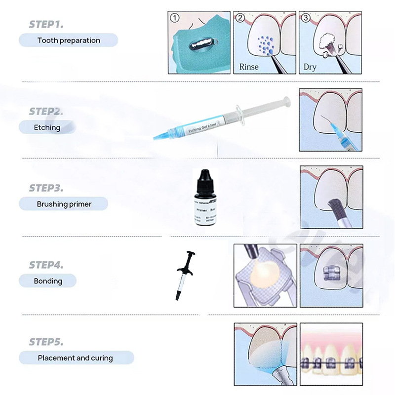 Dental Light Curing Orthodonti - Dental Impression Material Kit recension och pris